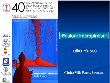 Fusion: interspinosa - Prof. Tullio Russo - Napoli 11-13 maggio 2017
