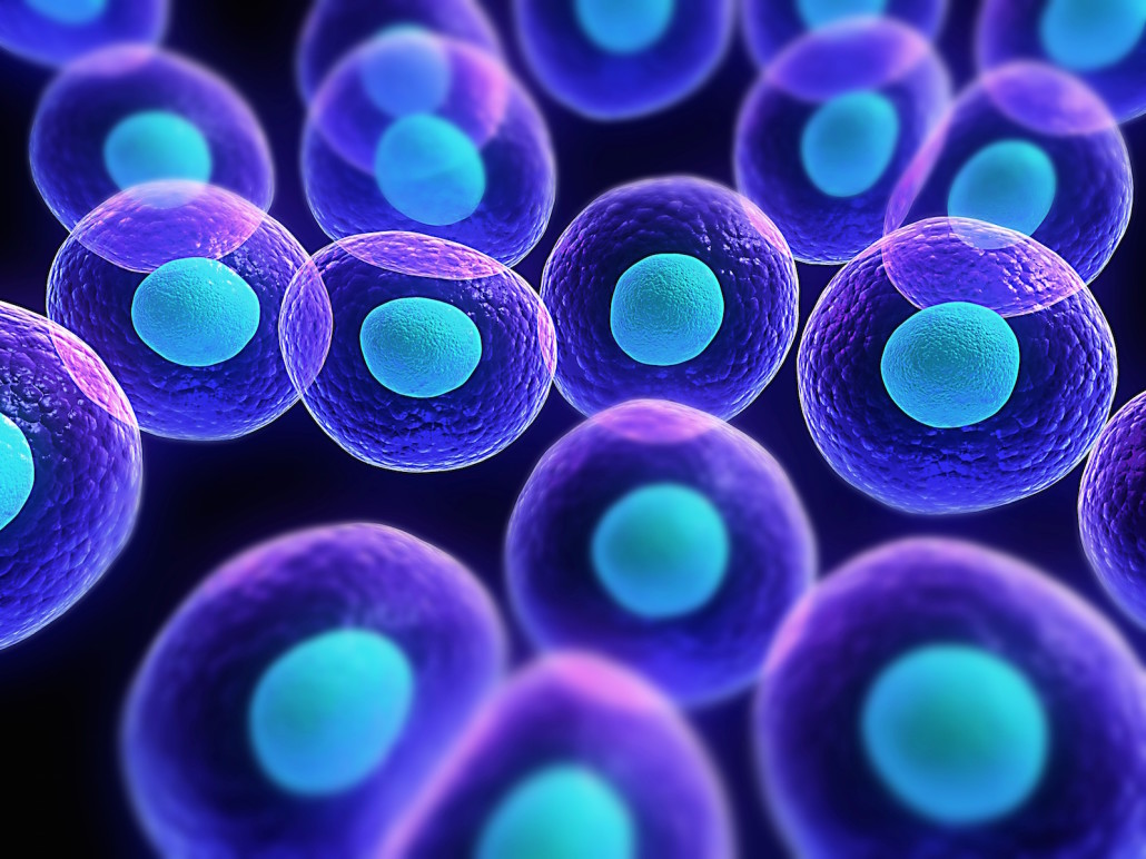 TRAPIANTO CELLULE STAMINALI AUTOLOGHE PER RIGENERAZIONE DISCO INTERVERTEBRALE