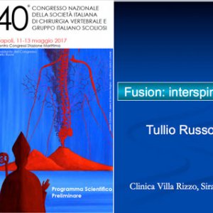 Fusion: interspinosa - Prof. Tullio Russo - Napoli 11-13 maggio 2017